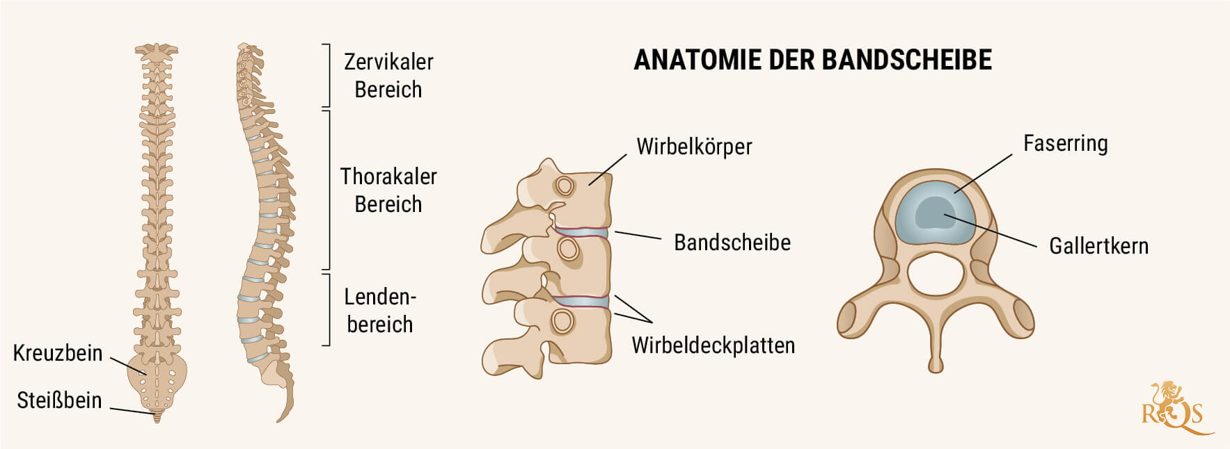 Was ist eine degenerative Bandscheibenveränderung?