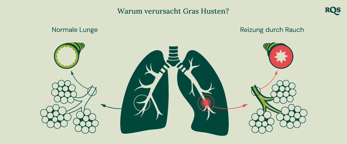 Diagramm der gesunden Lunge im Vergleich zur gereizten Lunge mit Entzündung und geschwollenen Bronchien durch Cannabisrauchen.