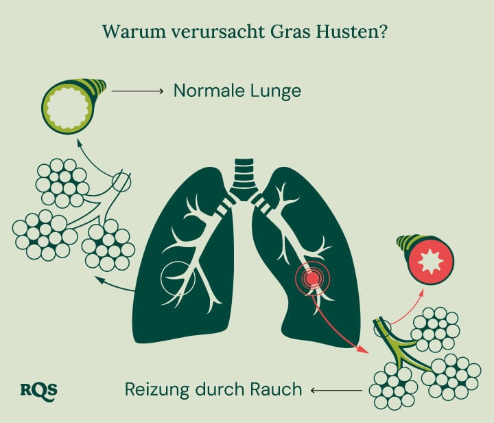 Diagramm der gesunden Lunge im Vergleich zur gereizten Lunge mit Entzündung und geschwollenen Bronchien durch Cannabisrauchen.